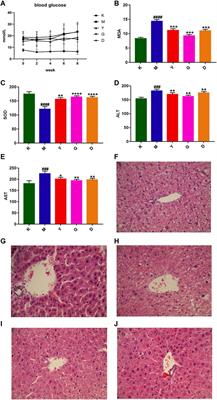 Integrating Network Pharmacology and Metabolomics to Elucidate the Mechanism of Action of Huang Qin Decoction for Treament of Diabetic Liver Injury